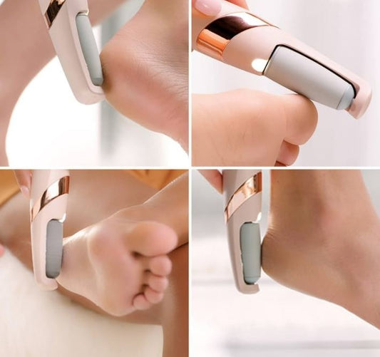 Rechargeable Callus Remover – Pedi Foot Care Device