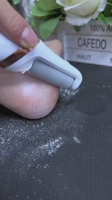 Rechargeable Callus Remover – Pedi Foot Care Device